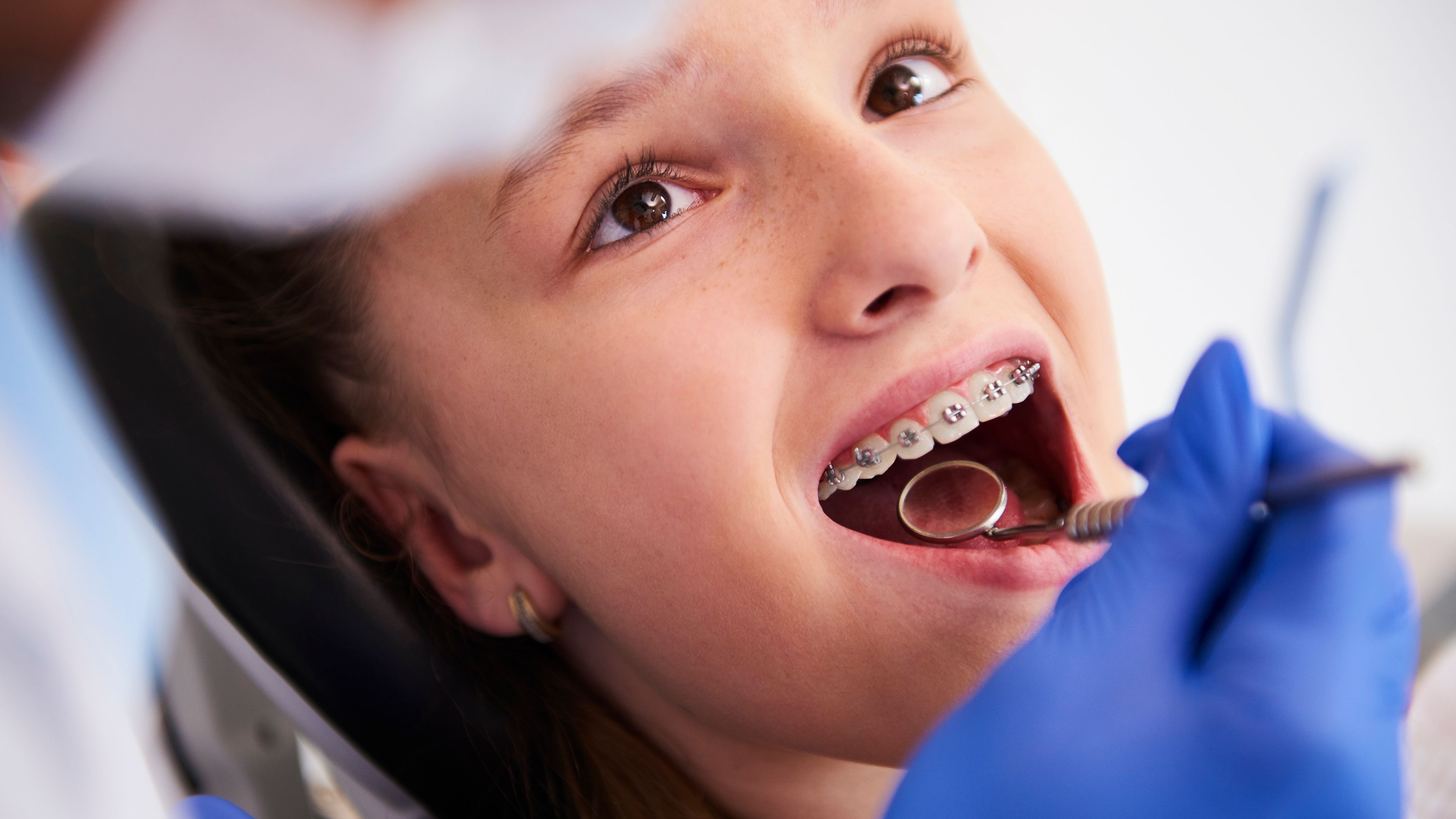 Ragazza con apparecchio ortodontico fisso durante un controllo nello studio dentistico di Mirano