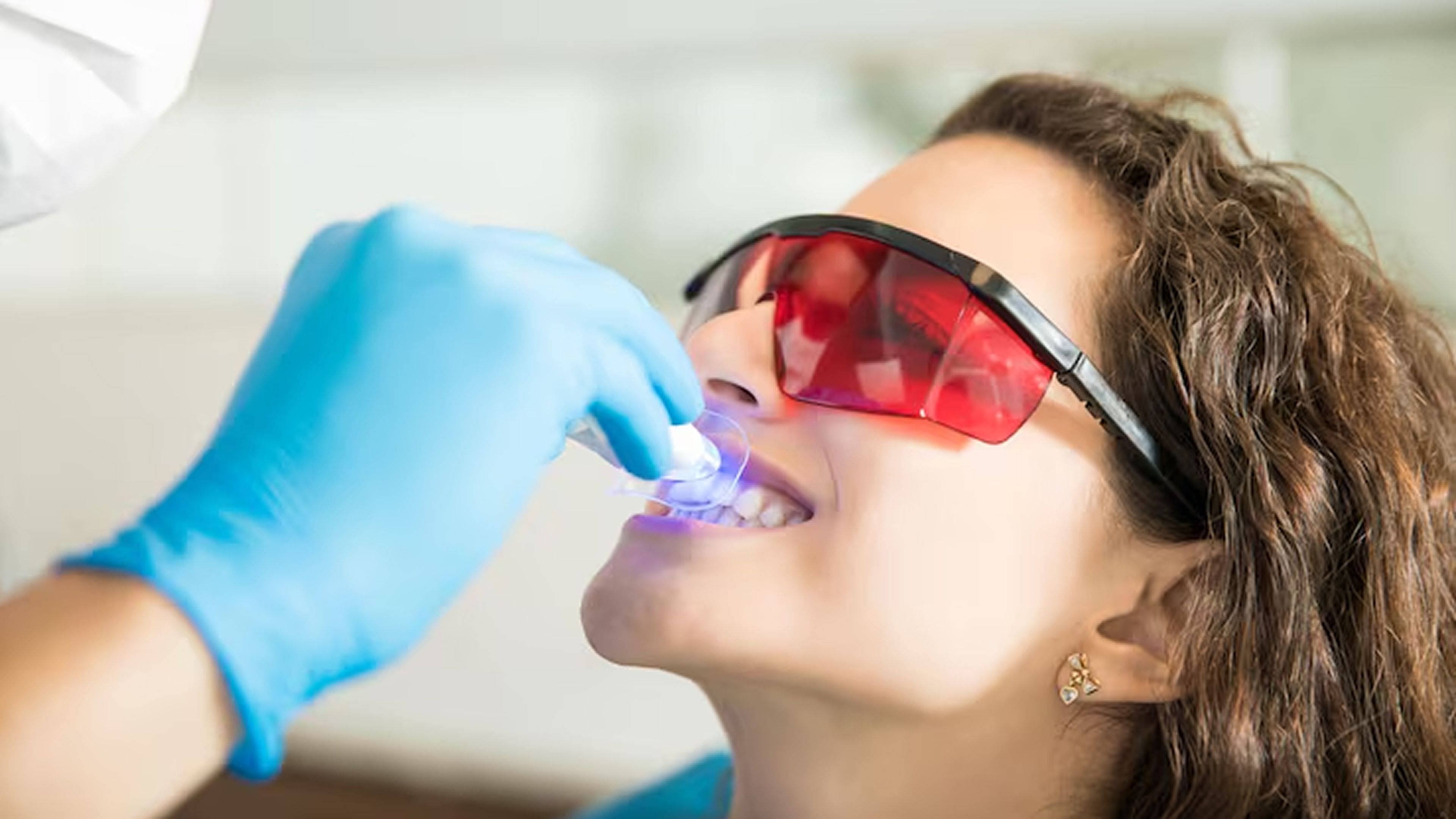 Seduta di sbiancamento dentale professionale con lampada a LED nello studio dentistico di Mirano