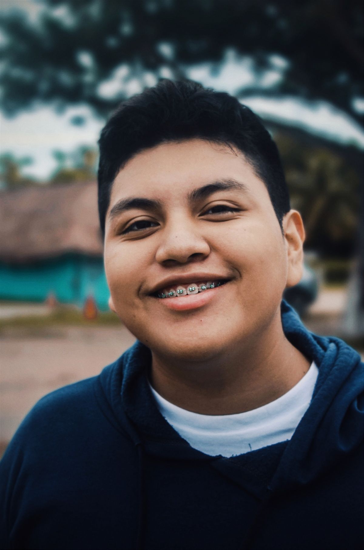 Ragazzo sorridente con apparecchio ortodontico fisso ai denti